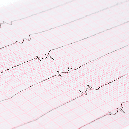 news-what-is-afib