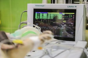 Atrial Fibrillation: Heart Monitor Machine